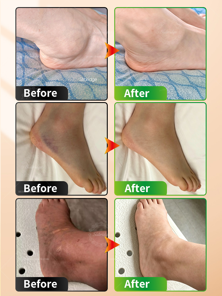 Portable Heated Ankle Massager - Ankle Mobility Band 评论和价格